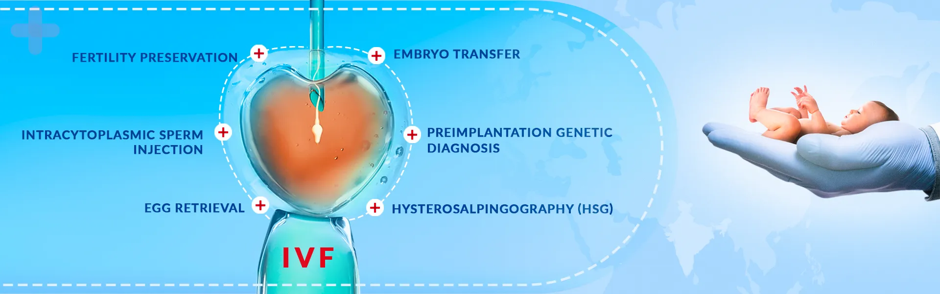 IVF