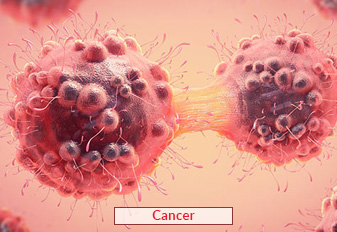 Cancer Treatment In India