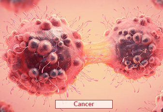 Traitement du cancer en Inde