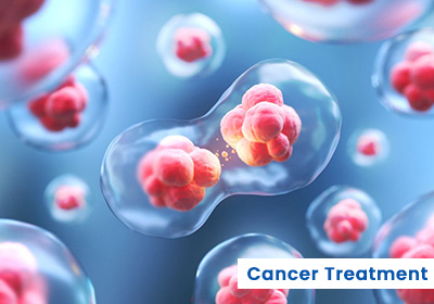 cancer treatment in india