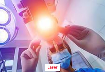 Laser Surgery In India