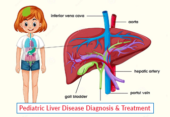 Diagnóstico e tratamento de doença hepática pediátrica