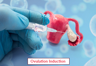 Ovulation Induction in india