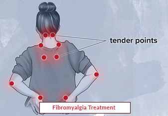 Tratamiento de la fibromialgia