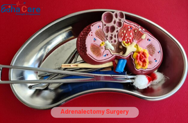 Cirugía de suprarrenalectomía