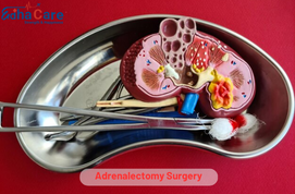 Cirurgia de adrenalectomia