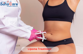 Traitement du lipome | Nouveau traitement pour le lipome ...