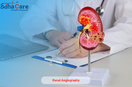 Renal Angiography