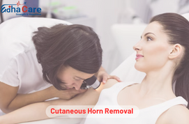 Cutaneous Horn Removal