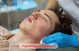 Traitement de pigmentation