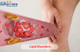 Lipid Bozuklukları