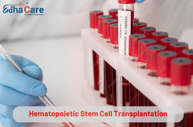 Trasplante de células madre hematopoyéticas (TCMH)