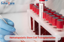 Hematopoietik Kök Hücre Transplantasyonu (HSCT)