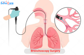 Brongoskopie Chirurgie
