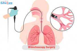 Cirurgia de Broncoscopia