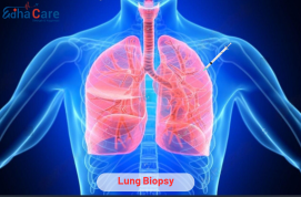 Lungenbiopsie
