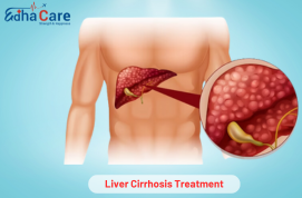 Tratamiento de cirrosis hepática