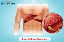 Liver Cirrhosis Treatment