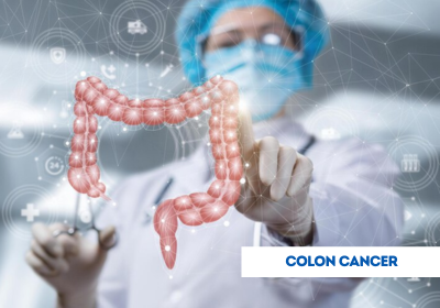 colon cancer treatment in india