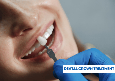 dental crown treatment in india