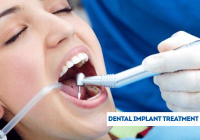 dental implantation in india