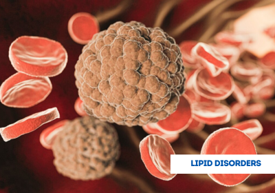 lipid disorder treatment in india