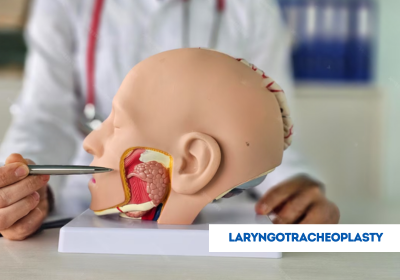 laryngotracheoplasty in india