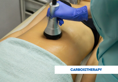 carboxytherapy in india