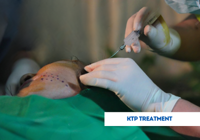 ktp treatment  in india