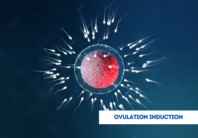 ovulation induction in india
