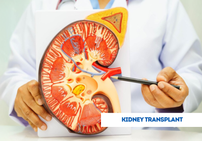 kidney transplant surgery in india