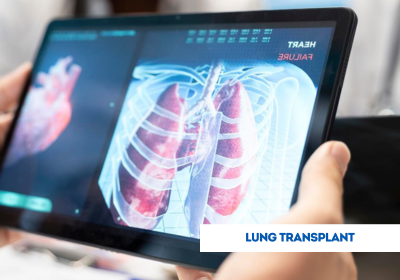 lung transplant surgery in india