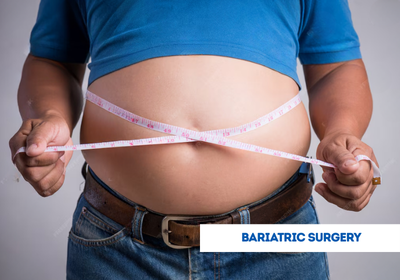 bariatric surgery in india