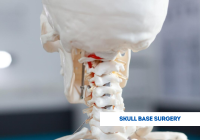 Skull Base Surgery | Skull Surgery | Skull Removal Surgery