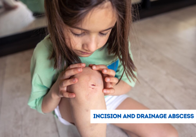 incision and drainage abscess surgery in india
