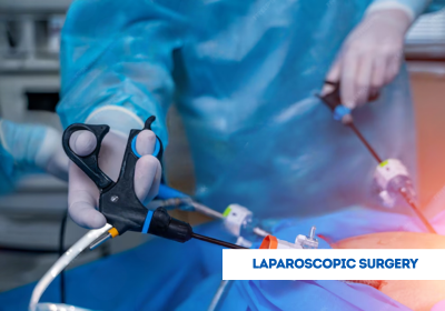 laparoscopic surgery in india
